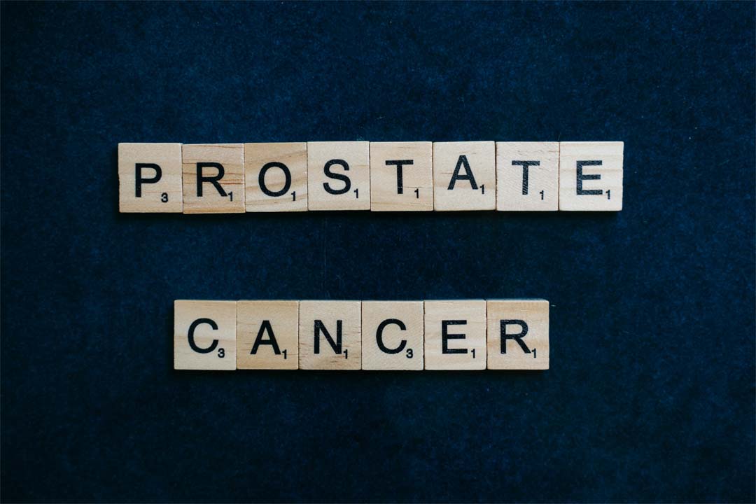 La masturbation réduit le risque de cancer de la prostate